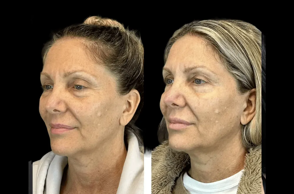 Why Natural-Looking Results Begin at the Best Aesthetic Clinic in Dubai